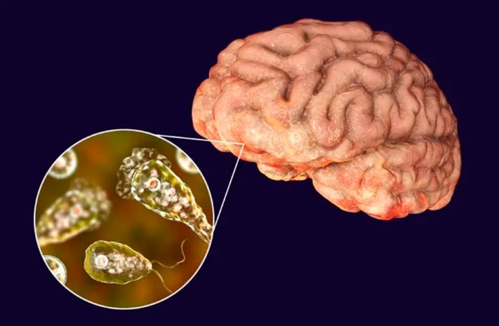 Homem morre após contrair “ameba comedora de cérebro” ao lavar o rosto