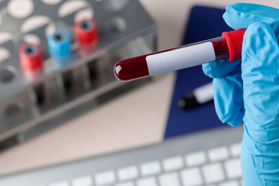Junho Laranja: oncologista alerta para a importância dos cuidados com a saúde do sangue